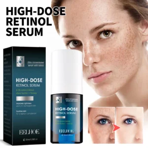 Retinol Face Serum Facial Dark Spot Remover